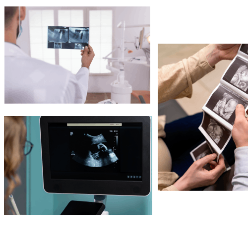 sippacs-pacs-radiology-sonograghy-graphic-software