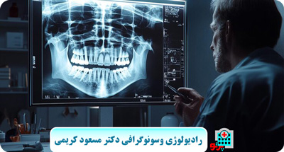radiology-OPG-pacs