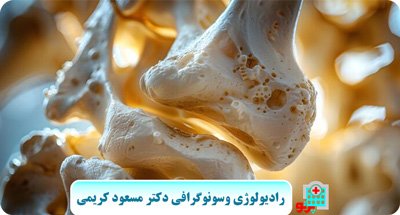 سنجش و تراکم استخوان